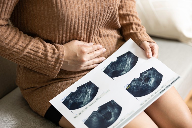 Woman holding bladder cancer test results