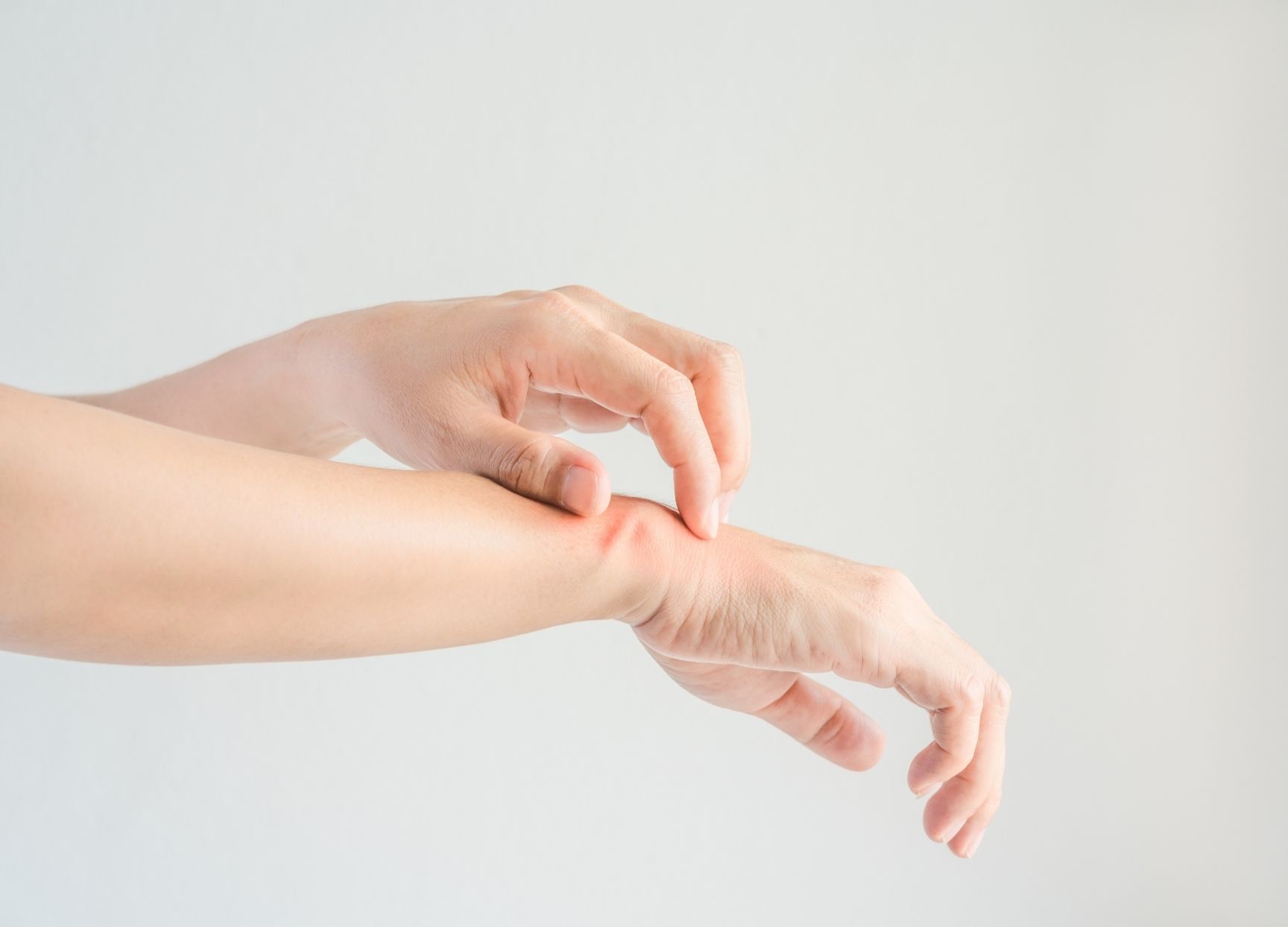 Private eczema and dermatitis treatments
