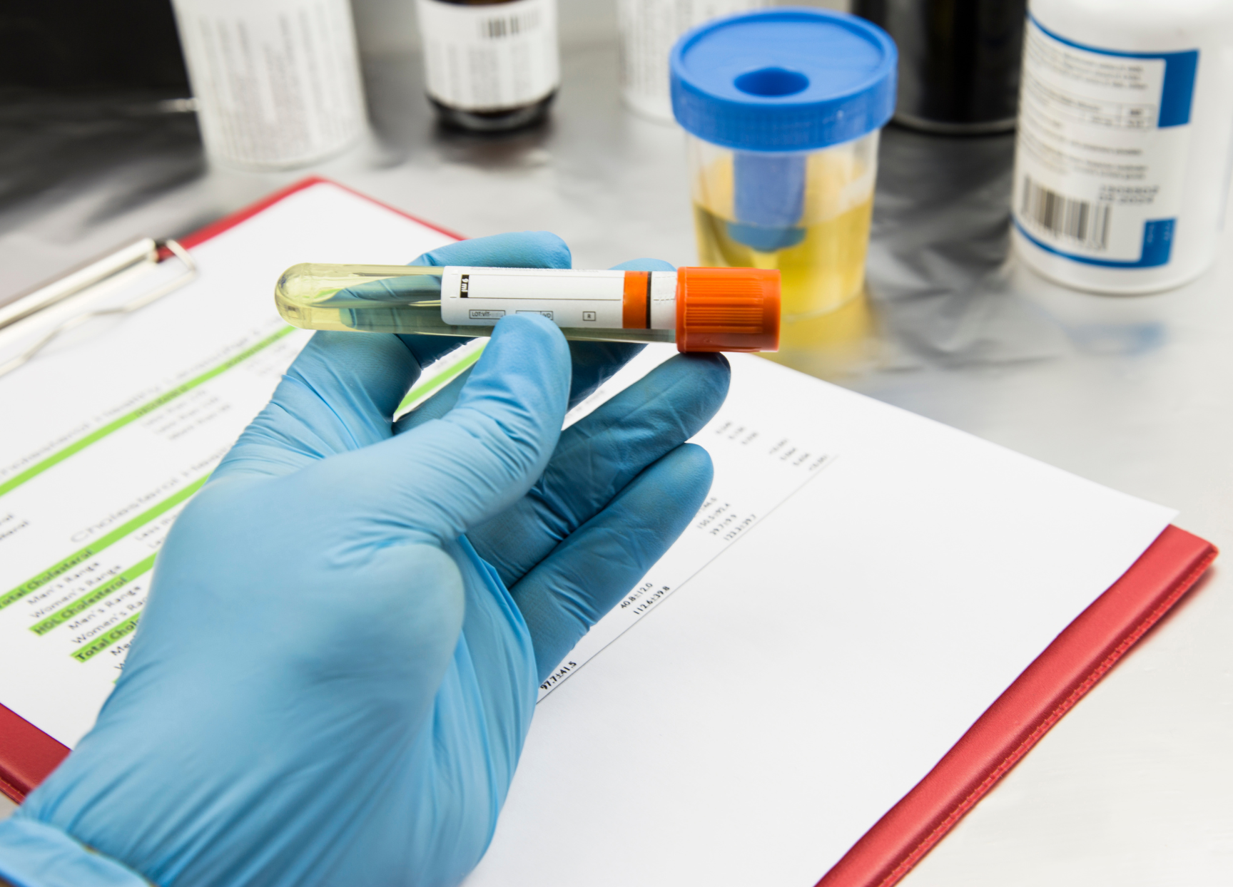 Treatment urinary incontinence  - OneWelbeck