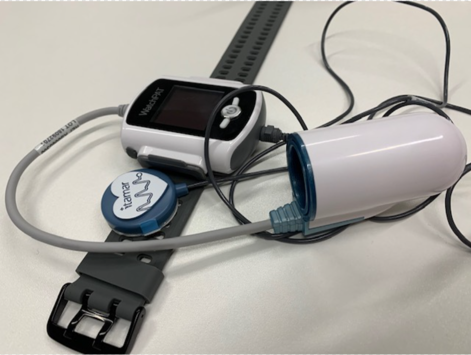 Sleep Apnoea Is Recognised An Emerging Cause Of Atrial Fibrillation