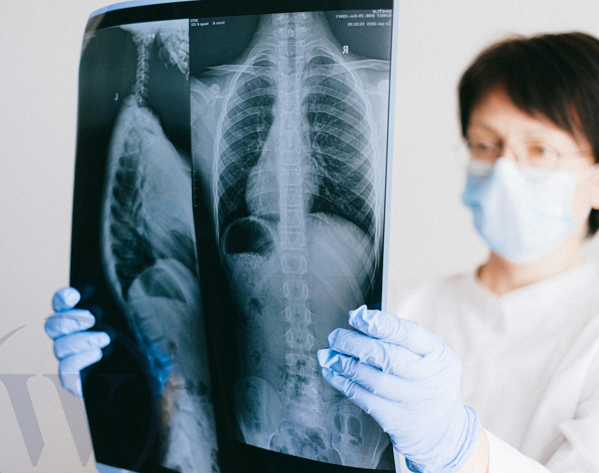 COPD and Cough: What You Need to Know
