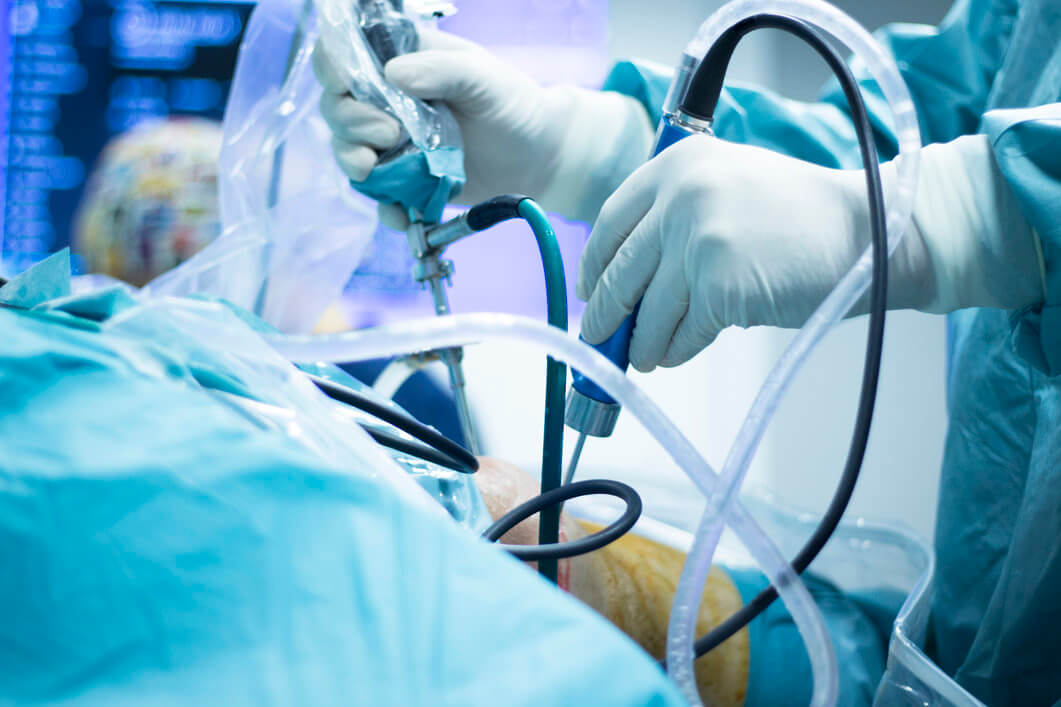 private arthroscopy in London at OneWelbeck