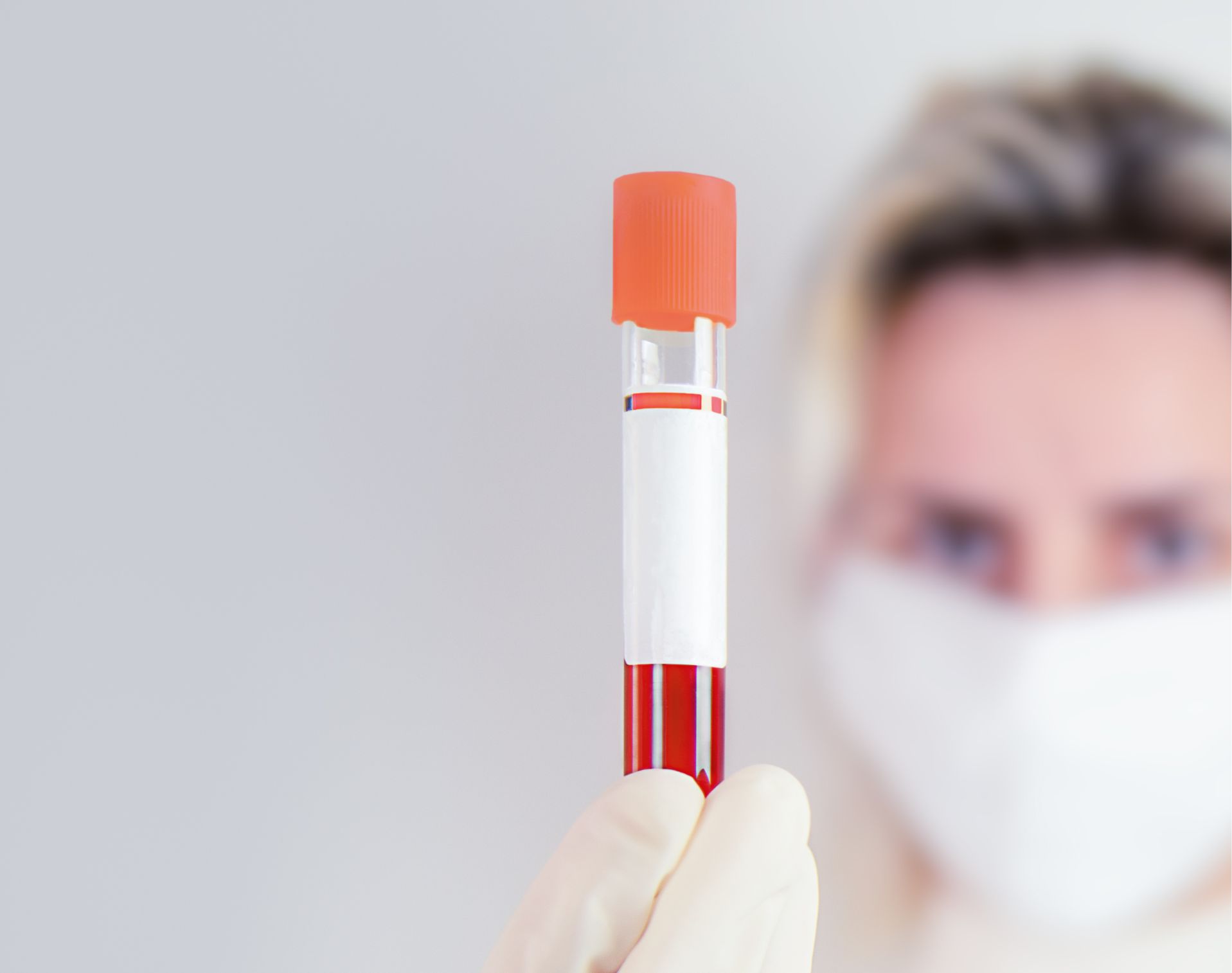 Private Allergy Testing